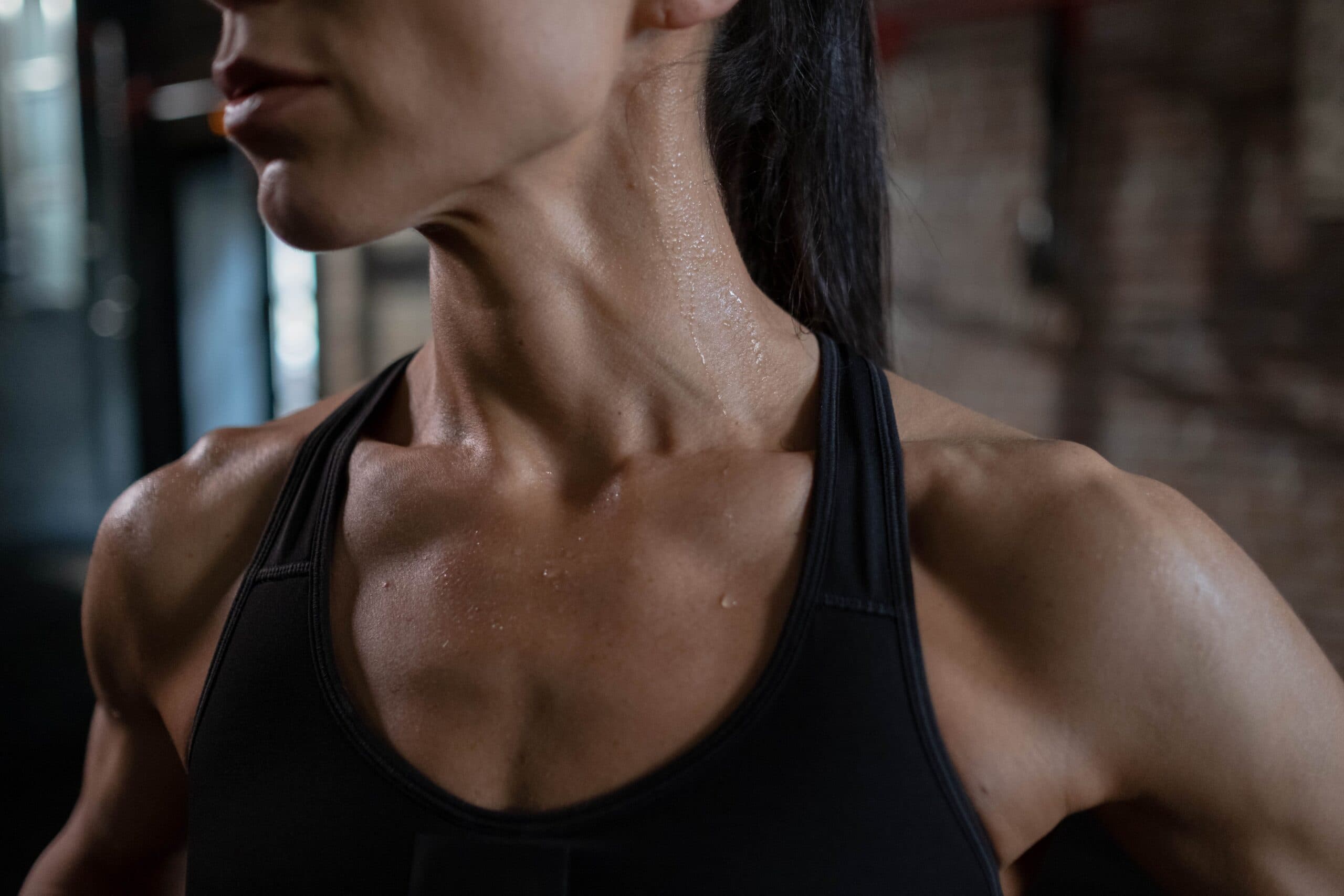 Hyperhidrosis girl sweating