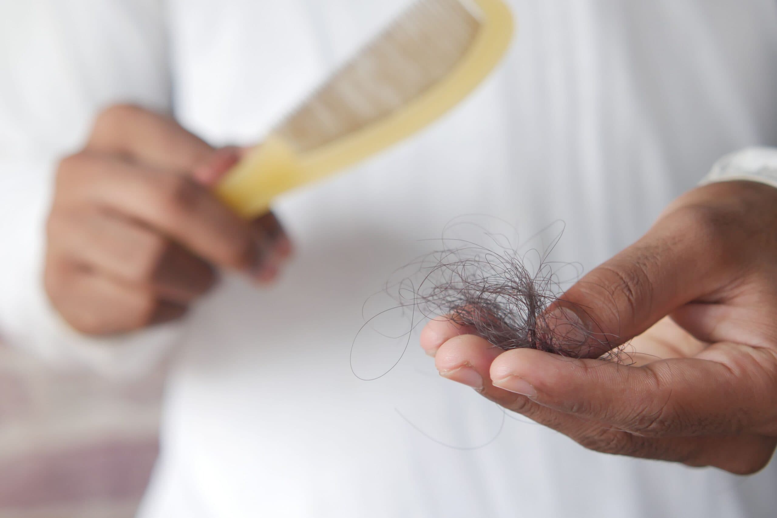 Dutasteride Mesotherapy: A Targeted Option for Hair Loss
